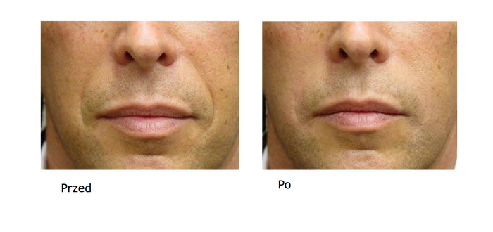 Popraw swoją urodę dzięki medycynie estetycznej